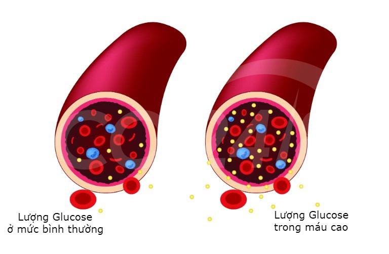 Lượng Glucose trong máu phản ánh tình trạng đường huyết